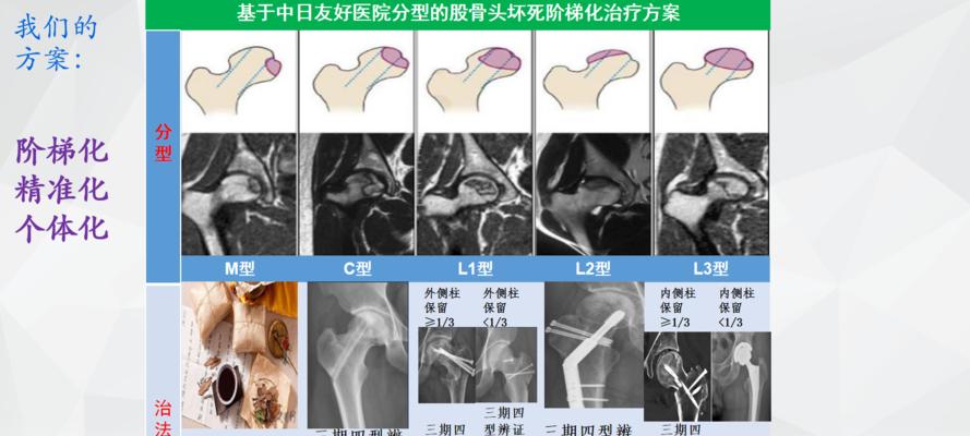 狗股骨头坏死药物治疗全攻略（以宠物为主）