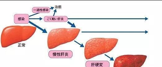 揭秘猫咪肝硬化的成因（探究肝硬化对宠物健康的影响及防治措施）