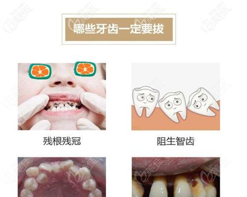 泰迪拔牙多少钱？拔牙前需要做哪些准备工作？